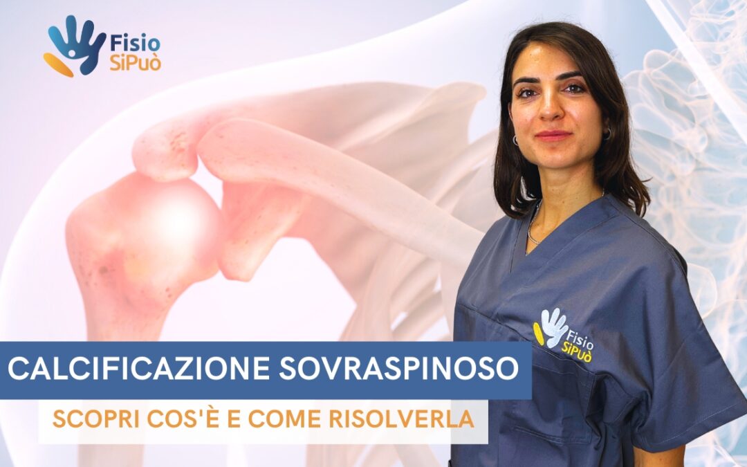 Calcificazione del Sovraspinoso: Scopri Cos’è e Come Risolverla