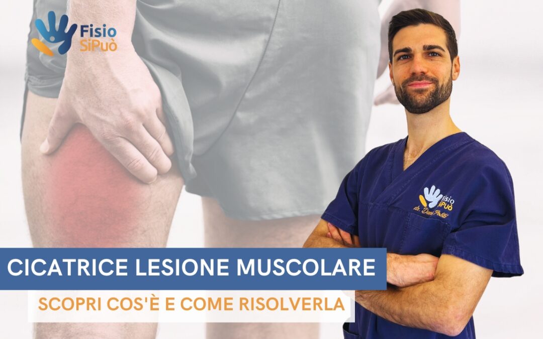 Cicatrice da Lesione Muscolare: Scopri Cos’è e Come Risolverla